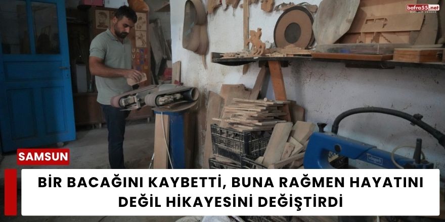 Bir Bacağını Kaybetti, Buna Rağmen Hayatını Değil Hikayesini Değiştirdi
