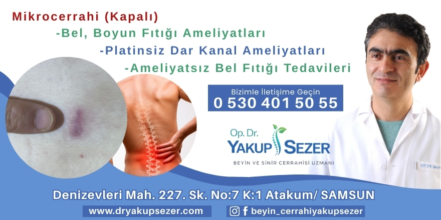 Bel Ağrısı Var Diye Ameliyat Olunur mu? Uzmanından Net Yanıt