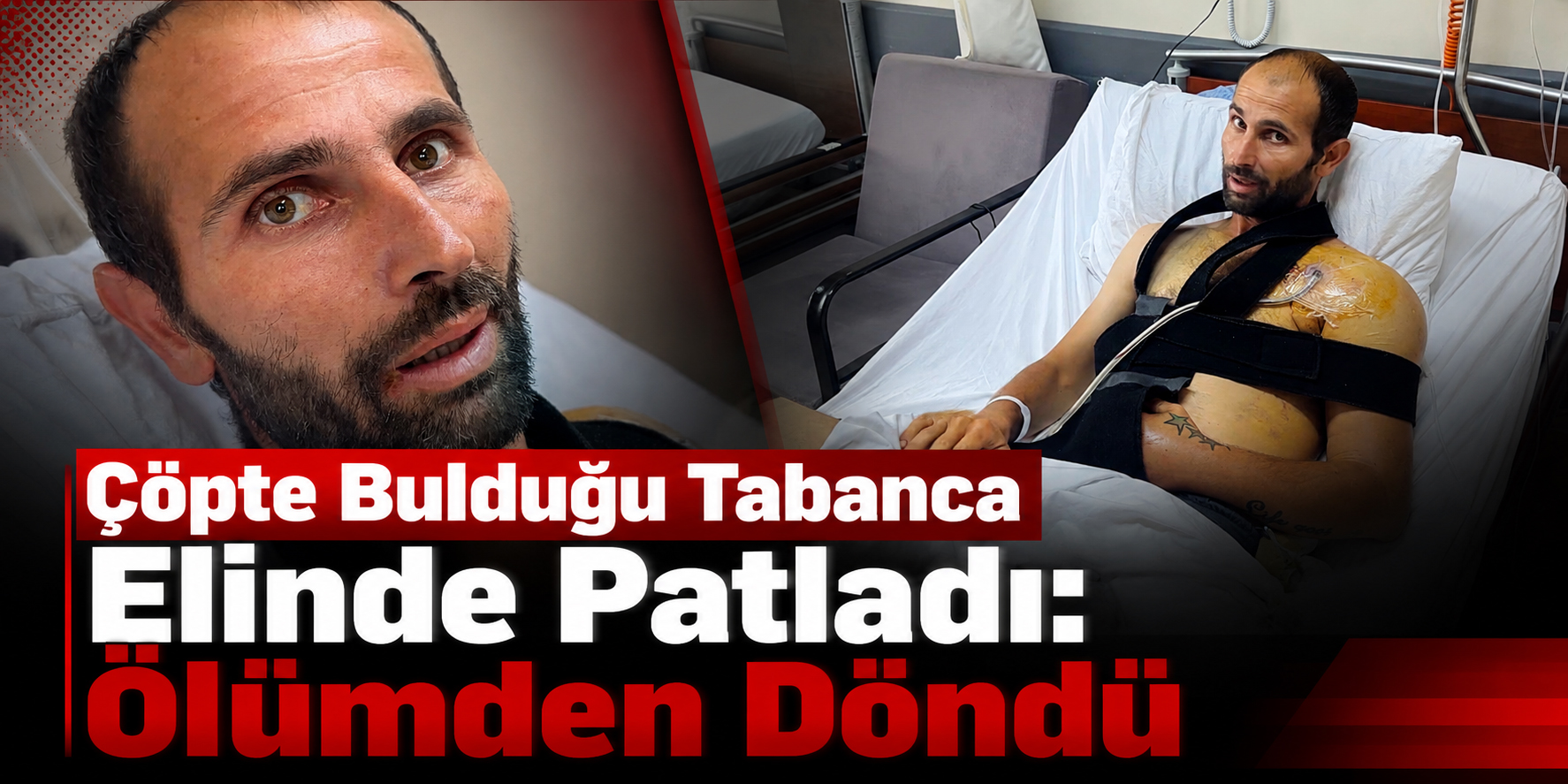 Çöpte Bulduğu Tabanca Elinde Patladı: Ölümden Döndü
