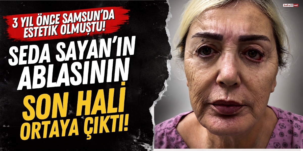 3 Yıl Önce Samsun’da Estetik Olmuştu! Seda Sayan’ın Ablasının Son Hali Ortaya Çıktı