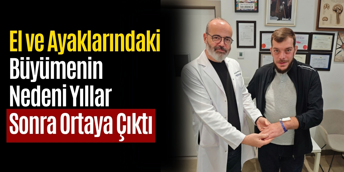 El ve Ayaklarındaki Büyümenin Nedeni Yıllar Sonra Ortaya Çıktı
