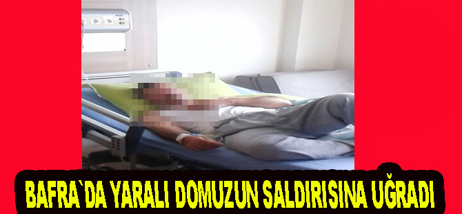 Yaralı domuzun saldırısına uğradı