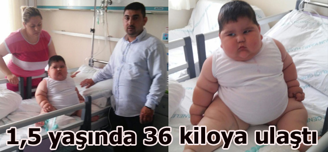 1,5 yaşında 36 kiloya ulaştı