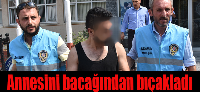 Annesini bacağından bıçakladı