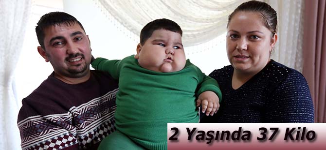 2 Yaşında 37 Kilo