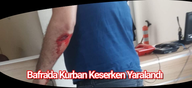 Bafra'da Kurban Keserken Yaralandı