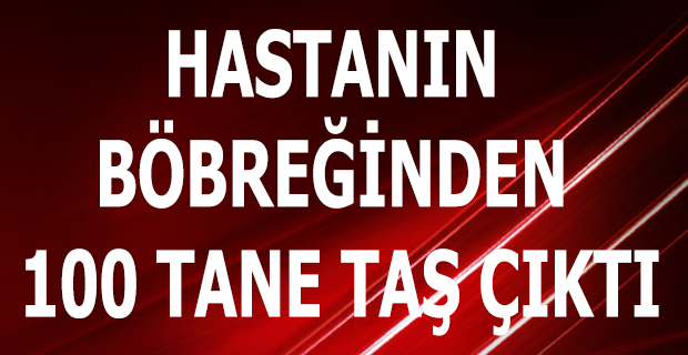 Niğde’de rahatsızlanan bir hastanın böbreğinden 100 tane taş çıktı.