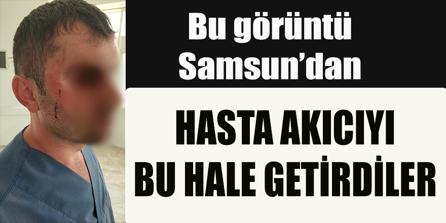 Samsun'da hasta bakıcıyı bu hale getirdiler