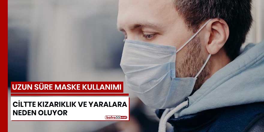 Uzun süre maske kullanımı ciltte kızarıklık ve yaralara neden oluyor