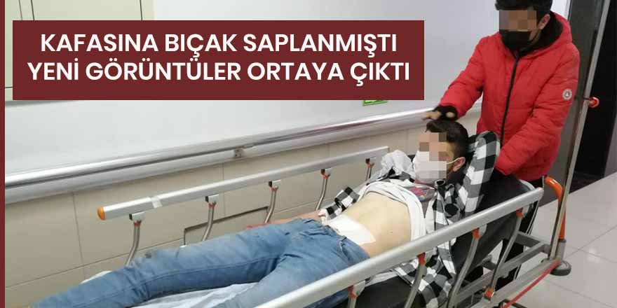 Kafasına bıçak saplanmıştı: Yeni görüntüler ortaya çıktı