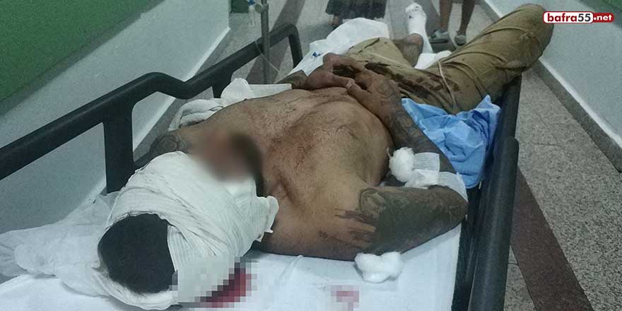 Samsun'da bıçaklı saldırıda yaralandı