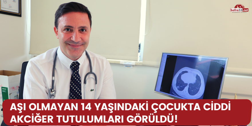 Aşı olmayan 14 yaşındaki çocukta ciddi akciğer tutulumları görüldü!