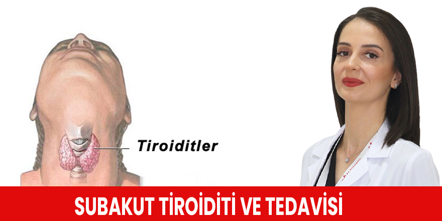 Subakut tiroiditi ve tedavisi