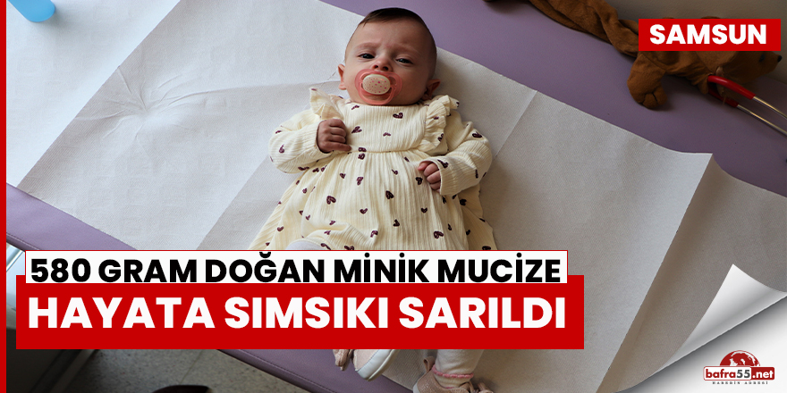 580 gram doğan minik mucize