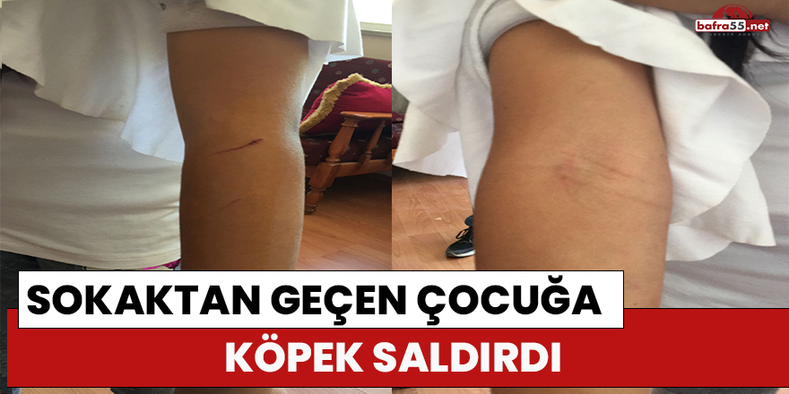 Bafra'da sokaktan geçen çocuğa köpek saldırdı