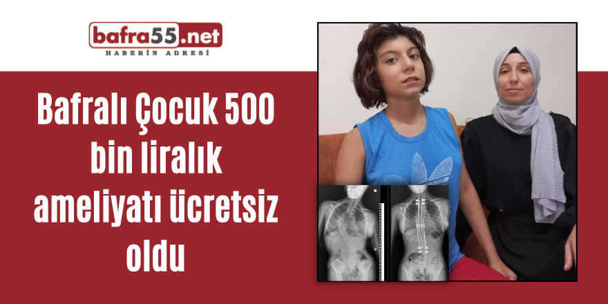 Bafralı Çocuk 500 bin liralık ameliyatı ücretsiz oldu