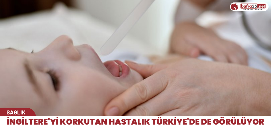 İngiltere'yi korkutan Hastalık Türkiye'de de görülüyor