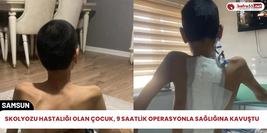 Skolyozu hastalığı olan çocuk, 9 saatlik operasyonla sağlığına kavuştu