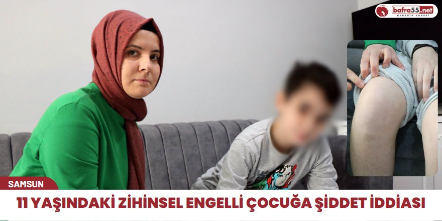 11 Yaşındaki Zihinsel Engelli Çocuğa Şiddet İddiası