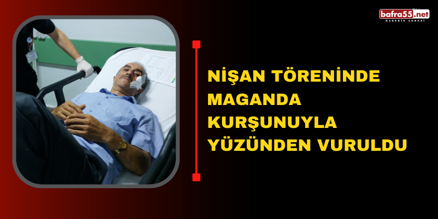 Nişan töreninde maganda kurşunuyla yüzünden vuruldu