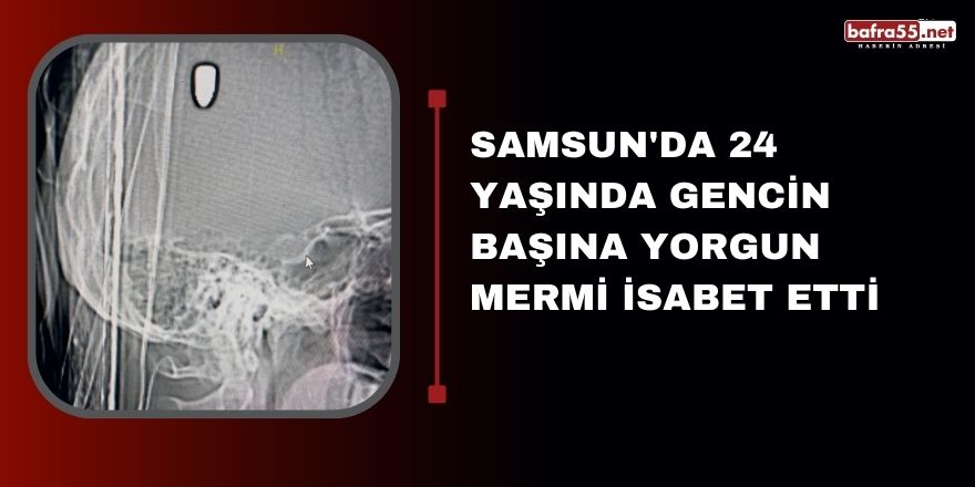 Samsun'da 24 yaşında gencin başına yorgun mermi isabet etti