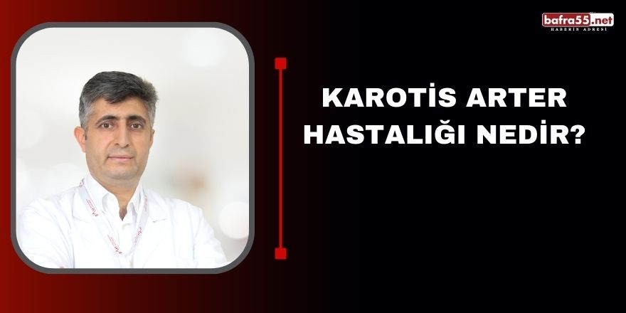 Karotis Arter Hastalığı Nedir?