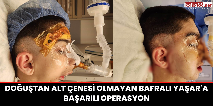 Doğuştan alt çenesi olmayan Bafralı Yaşar'a başarılı operasyon