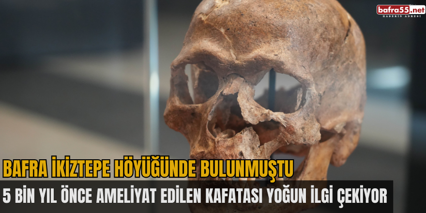 5 bin yıl önce ameliyat edilen kafatası yoğun ilgi çekiyor