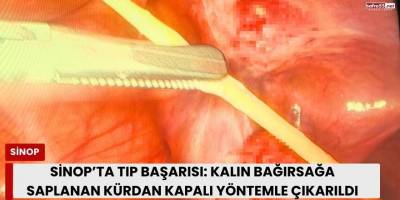 Sinop’ta Tıp Başarısı: Kalın Bağırsağa Saplanan Kürdan Kapalı Yöntemle Çıkarıldı