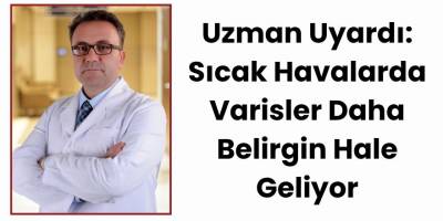 Uzman Uyardı: Sıcak Havalarda Varisler Daha Belirgin Hale Geliyor