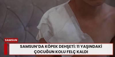 Samsun’da Köpek Dehşeti: 11 Yaşındaki Çocuğun Kolu Felç Kaldı