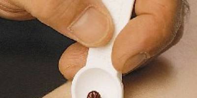 2 YAŞINDAKİ ÇOCUĞU KENE ISRDI