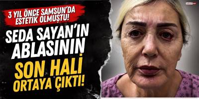 3 Yıl Önce Samsun’da Estetik Olmuştu! Seda Sayan’ın Ablasının Son Hali Ortaya Çıktı