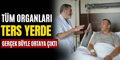 Tüm Organları Ters Yerde Gerçek Böyle Ortaya Çıktı