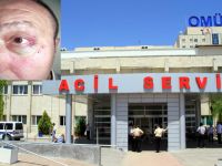 BAFRALI VATANDAŞ DOÇENTİ DARP ETTİ