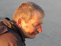 BALIK TUTARKEN HASTANELİK OLDU