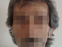 ESRAR TARLASINA ELEKTRİKLİ TUZAK