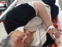 OTOMOBİLİN ÇARPTIĞI YAŞLI KADIN HASTANELİK OLDU