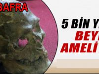 5 bin yıllık beyin ameliyatı