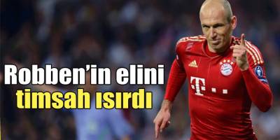 ROBENİ TİMSAH ISIRDI