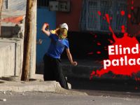 Polise atacaktı elinde patladı