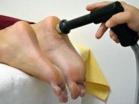 Topuk Dikenine Şok Dalga Yöntemi İle Çözüm