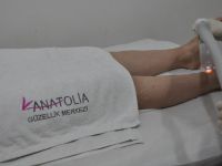 Erkeklerin Lazer Epilosyona İlgisi Artıyor