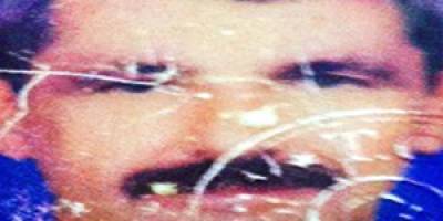 Kalbi duran adam hastanede yaşama tutundu