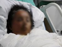 Eşini yakan koca, evden uzaklaştırma cezası almış !