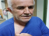 Vücuduna tutunan keneyi kendi çıkarıp hastaneye başvurdu