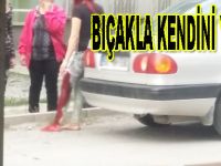 Kendi Kendini Yaraladı
