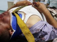 Otomobil ile motosiklet çarpıştı: 1 yaralı