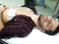 Samsun'da bıçaklı saldırıya uğrayan genç hastanelik oldu.