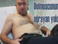 Dolmuş şoförü yolcuyu ayna için bıçakladı